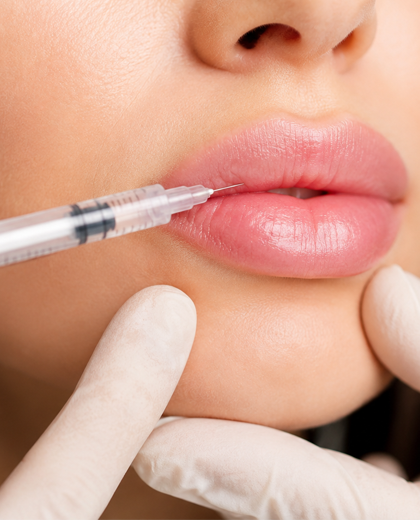 Kusadasi lip fillers
